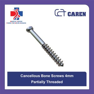 پیچ ارتوپدی کنسلوس 4mm نیم رزوه (Partially Threaded) - برند کارن