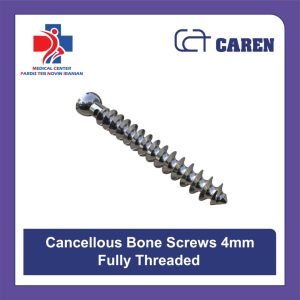 پیچ استخوان کنسلوس 4 میلی‌متر تمام رزوه (Fully Threaded) برند کارن