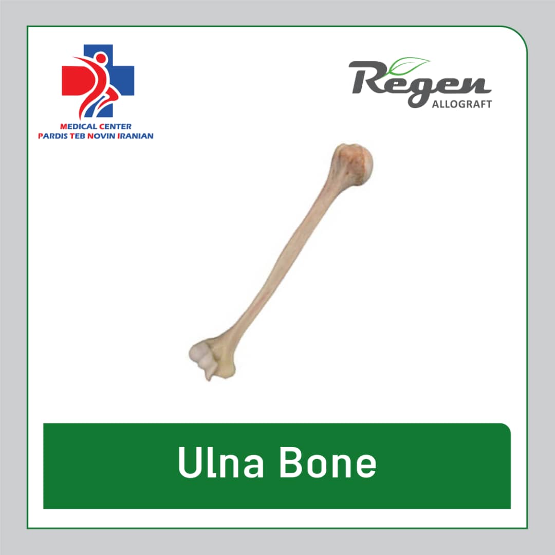 آلوگرافت استخوان اولنا (Ulna Bone) برند Regen