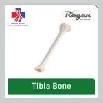 گرافت استخوان درشت‌نی ریجن آلوگرافت (Regen Allograft Tibia Bone)