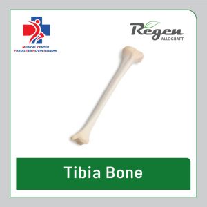 گرافت استخوان درشت‌نی ریجن آلوگرافت (Regen Allograft Tibia Bone)