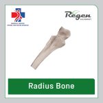گرافت استخوانی رادیوس ریجن (Regen Allograft Radius Bone)