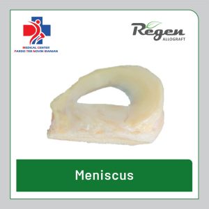 آلوگرافت منیسک زانو (Meniscus Allograft) برند Regen