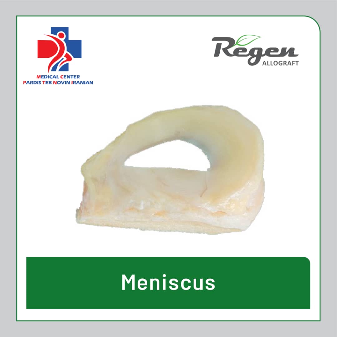 آلوگرافت منیسک زانو (Meniscus Allograft) برند Regen