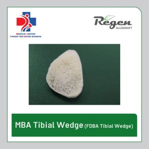 ودج استخوانی تیبیا ریجن (Regen Allograft MBA Tibial Wedge - FDBA)
