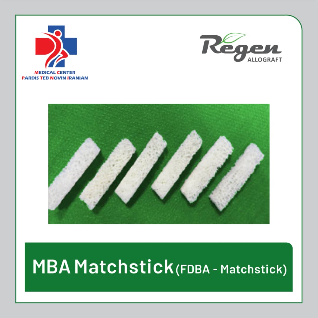 MBA Matchstick FDBA | خرید آلوگرافت | پردیس طب نوین ایرانیان